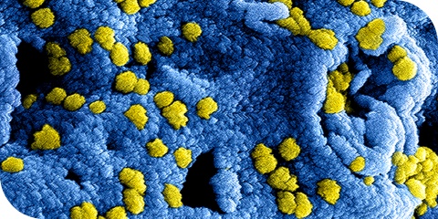 Coronavirus en de afvalbranche